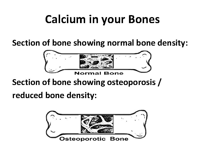 Calcium in your Bones Section of bone showing normal bone density: Section of bone