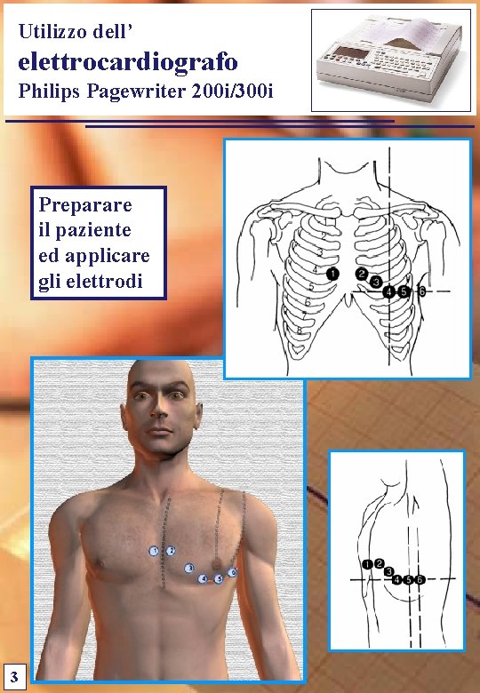Utilizzo dell’ elettrocardiografo Philips Pagewriter 200 i/300 i Preparare il paziente ed applicare gli