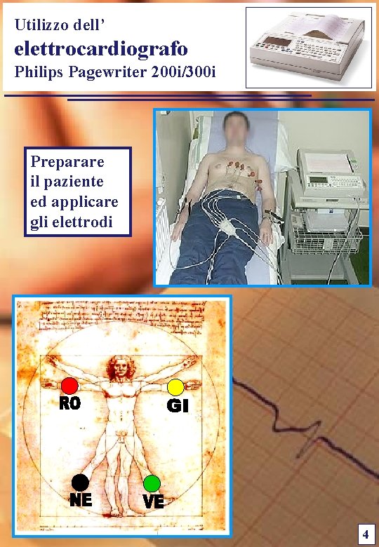 Utilizzo dell’ elettrocardiografo Philips Pagewriter 200 i/300 i Preparare il paziente ed applicare gli