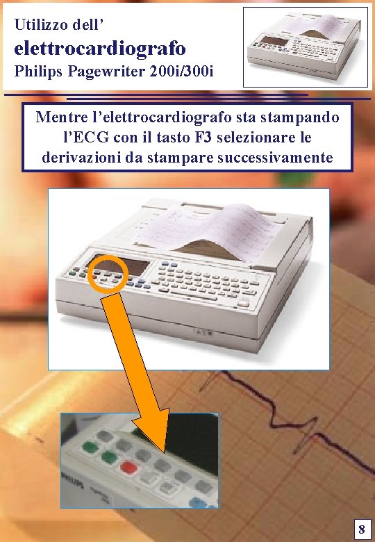 Utilizzo dell’ elettrocardiografo Philips Pagewriter 200 i/300 i Mentre l’elettrocardiografo stampando l’ECG con il