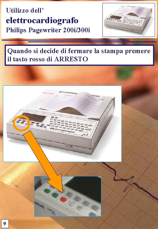 Utilizzo dell’ elettrocardiografo Philips Pagewriter 200 i/300 i Quando si decide di fermare la