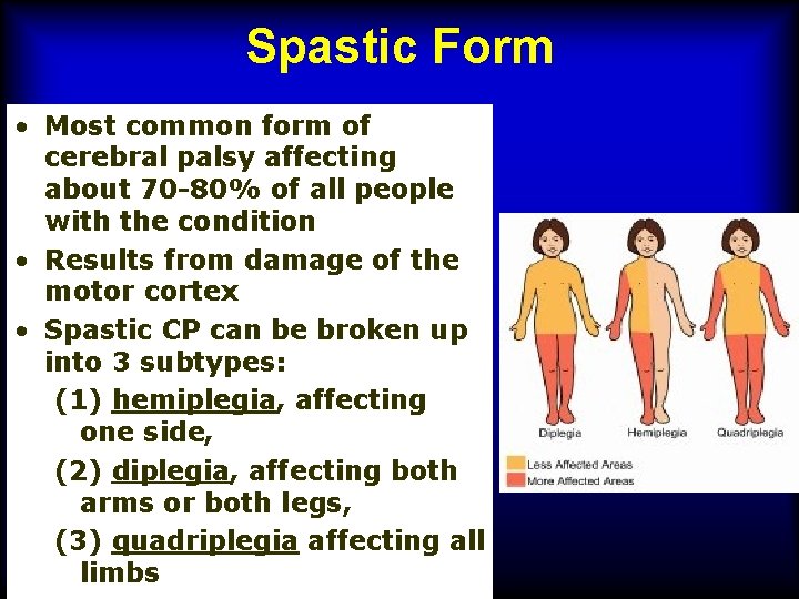 Spastic Form • Most common form of cerebral palsy affecting about 70 -80% of