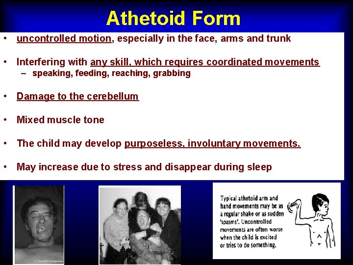 Athetoid Form • uncontrolled motion, especially in the face, arms and trunk • Interfering