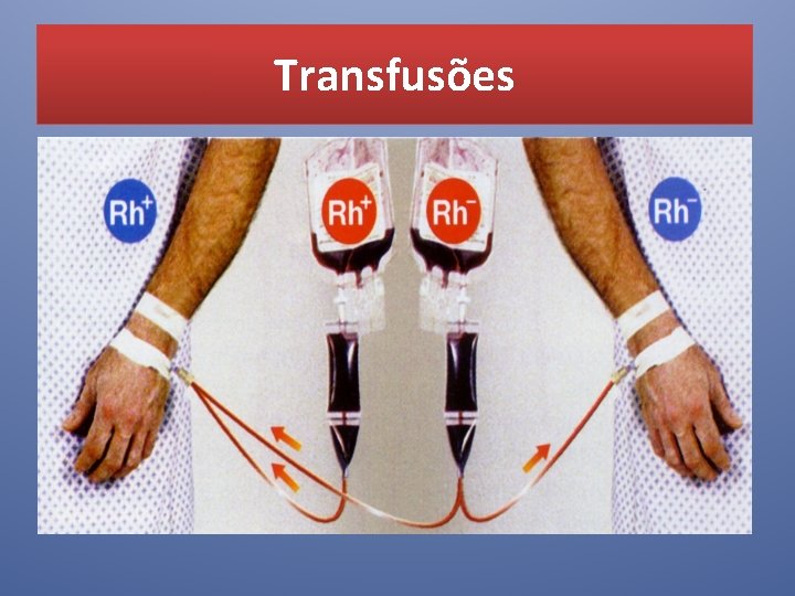 Transfusões 