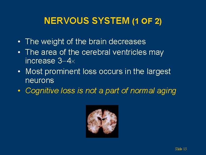 NERVOUS SYSTEM (1 OF 2) • The weight of the brain decreases • The