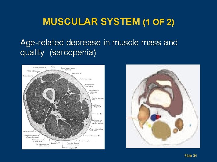MUSCULAR SYSTEM (1 OF 2) Age-related decrease in muscle mass and quality (sarcopenia) Slide