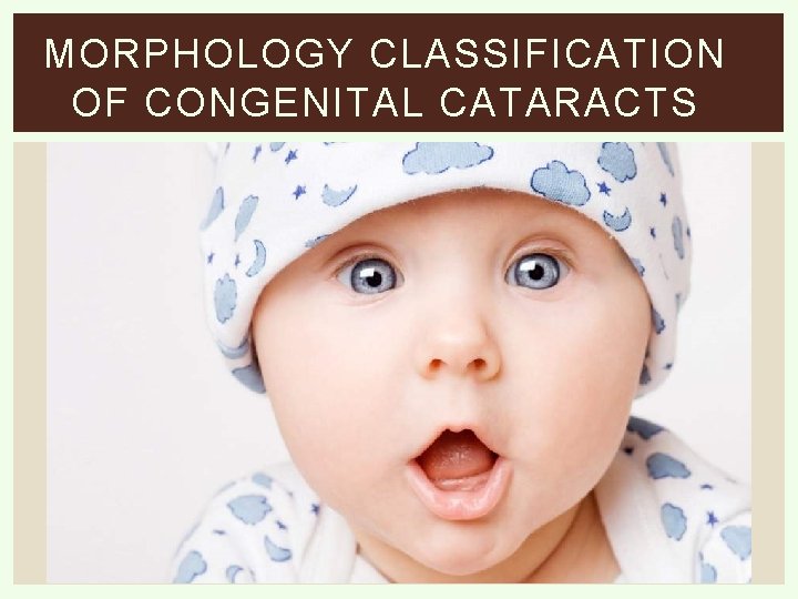 MORPHOLOGY CLASSIFICATION OF CONGENITAL CATARACTS 