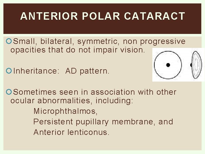 ANTERIOR POLAR CATARACT Small, bilateral, symmetric, non progressive opacities that do not impair vision.