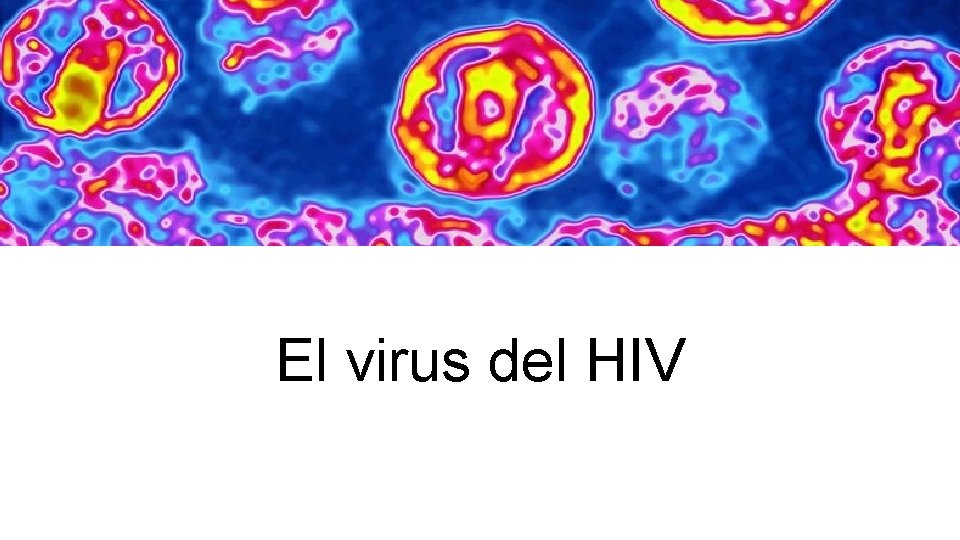 El virus del HIV 