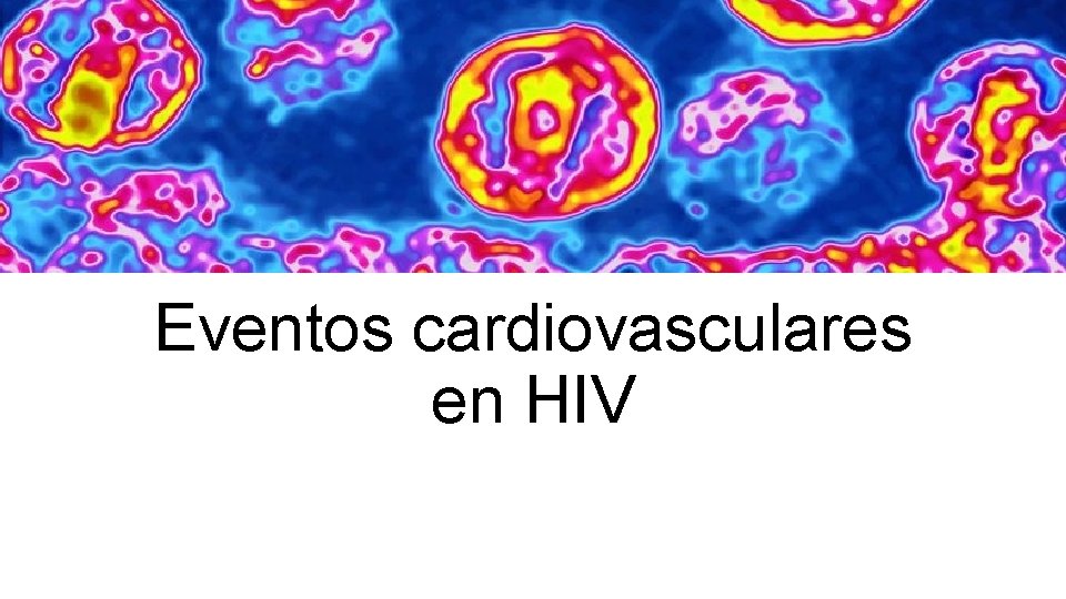 Eventos cardiovasculares en HIV 