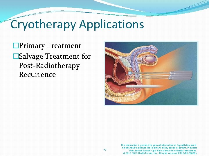 Cryotherapy Applications �Primary Treatment �Salvage Treatment for Post-Radiotherapy Recurrence 10 This information is provided Cryotherapy Applications �Primary Treatment �Salvage Treatment for Post-Radiotherapy Recurrence 10 This information is provided