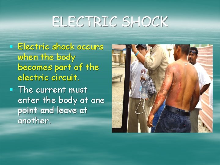 ELECTRIC SHOCK § Electric shock occurs when the body becomes part of the electric