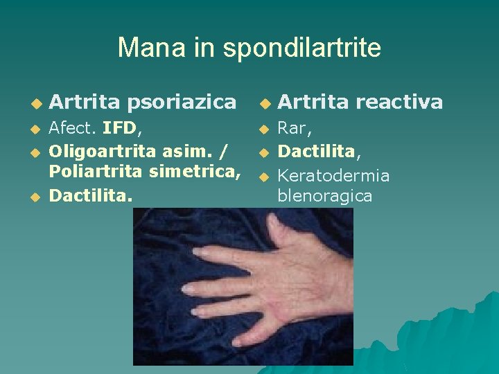 artrita reactiva virala tratamente pentru artrita artroza
