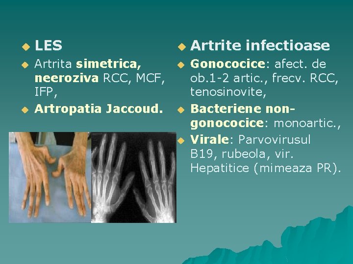 artrita sternoclaviculara)