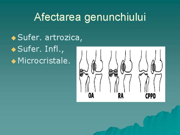 Afectarea genunchiului u Sufer. artrozica, u Sufer. Infl. , u Microcristale. 