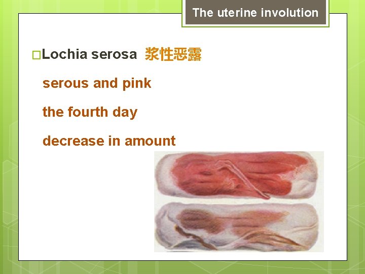 The uterine involution �Lochia serosa 浆性恶露 serous and pink the fourth day decrease in
