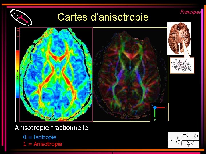 Cartes d’anisotropie Anisotropie fractionnelle 0 = Isotropie 1 = Anisotropie Principes Cartes d’anisotropie Anisotropie fractionnelle 0 = Isotropie 1 = Anisotropie Principes