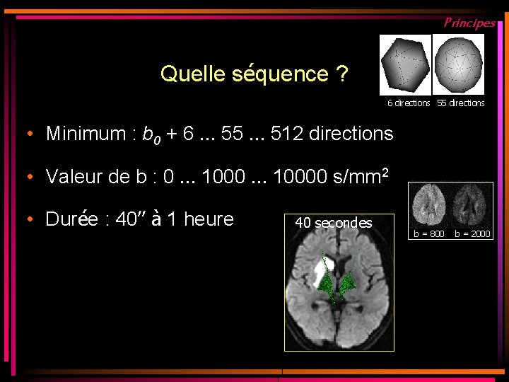 Principes Quelle séquence ? 6 directions 55 directions • Minimum : b 0 + Principes Quelle séquence ? 6 directions 55 directions • Minimum : b 0 +