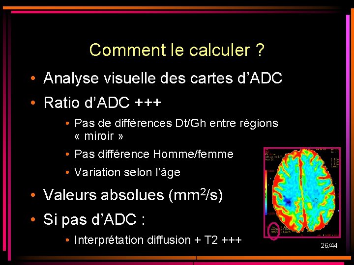 Comment le calculer ? • Analyse visuelle des cartes d’ADC • Ratio d’ADC +++ Comment le calculer ? • Analyse visuelle des cartes d’ADC • Ratio d’ADC +++