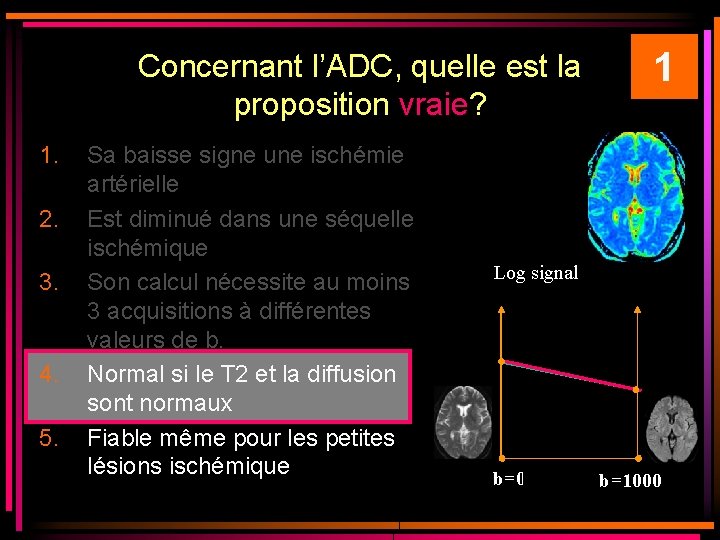 Concernant l’ADC, quelle est la proposition vraie? 1. 2. 3. 4. 5. Sa baisse Concernant l’ADC, quelle est la proposition vraie? 1. 2. 3. 4. 5. Sa baisse