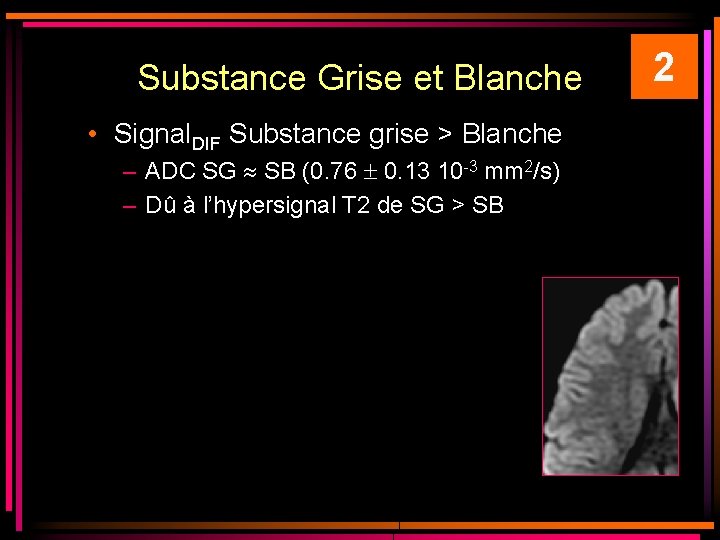 Substance Grise et Blanche • Signal. DIF Substance grise > Blanche – ADC SG Substance Grise et Blanche • Signal. DIF Substance grise > Blanche – ADC SG