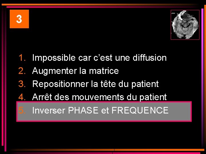 3 1. 2. 3. 4. 5. Impossible car c’est une diffusion Augmenter la matrice 3 1. 2. 3. 4. 5. Impossible car c’est une diffusion Augmenter la matrice