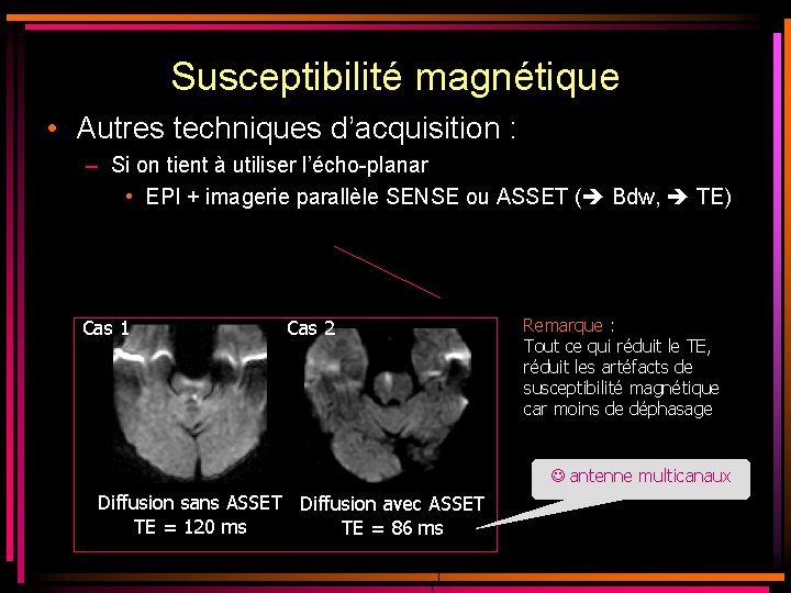 Susceptibilité magnétique • Autres techniques d’acquisition : – Si on tient à utiliser l’écho-planar Susceptibilité magnétique • Autres techniques d’acquisition : – Si on tient à utiliser l’écho-planar