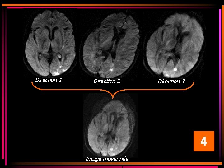 Direction 1 Direction 2 Direction 3 4 Image moyennée Direction 1 Direction 2 Direction 3 4 Image moyennée