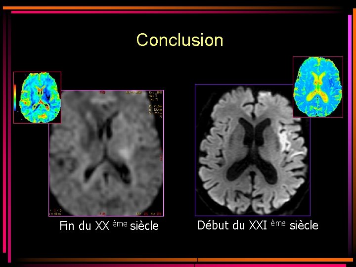 Conclusion Fin du XX ème siècle Début du XXI ème siècle Conclusion Fin du XX ème siècle Début du XXI ème siècle