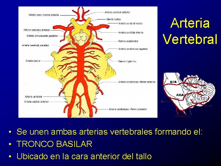 Arteria Vertebral • Se unen ambas arterias vertebrales formando el: • TRONCO BASILAR •