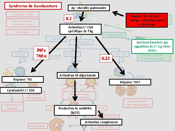 Syndrome de Goodpasture Ag : alvéolite pulmonaire Activation LT CD 4 TCR/CD 3 CD