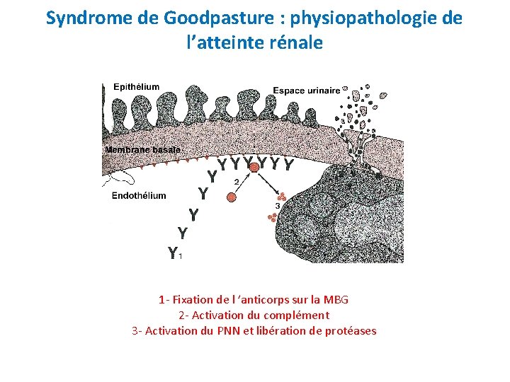 Syndrome de Goodpasture : physiopathologie de l’atteinte rénale 1 - Fixation de l ’anticorps