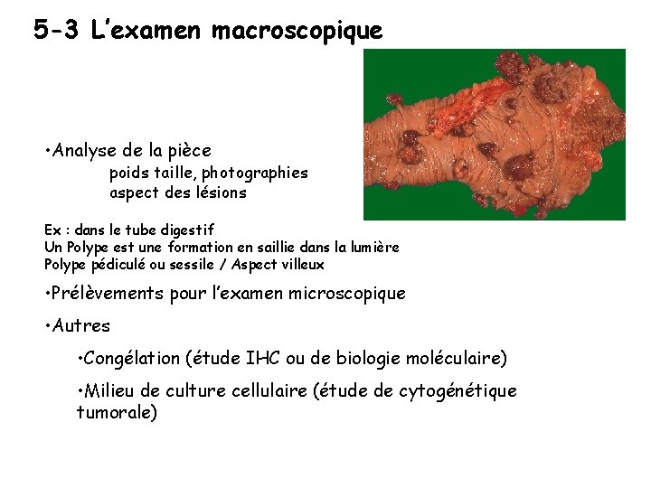 5 -3 L’examen macroscopique • Analyse de la pièce poids taille, photographies aspect des