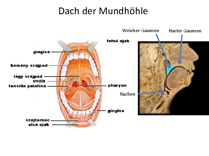 Dach der Mundhöhle Weicher Gaumen Rachen Harter Gaumen 