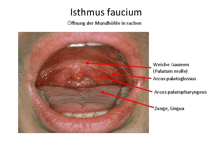 Isthmus faucium Öffnung der Mundhöhle in rachen Weiche Gaumen (Palatum molle) Arcus palatoglossus Arcus