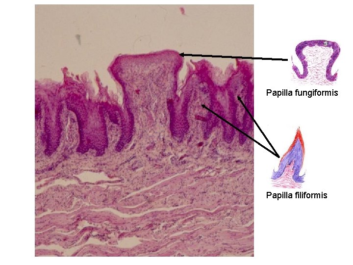 Papilla fungiformis Papilla filiformis 
