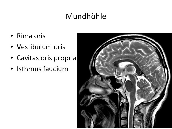 Mundhöhle • • Rima oris Vestibulum oris Cavitas oris propria Isthmus faucium 