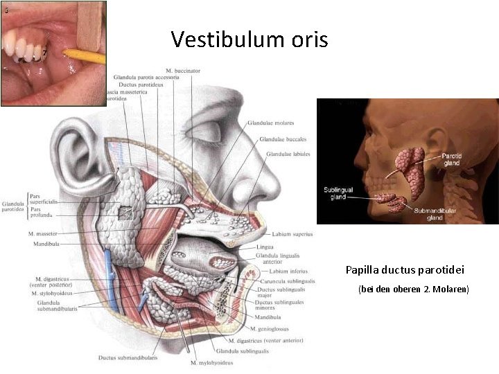 Vestibulum oris Papilla ductus parotidei (bei den oberen 2. Molaren) 