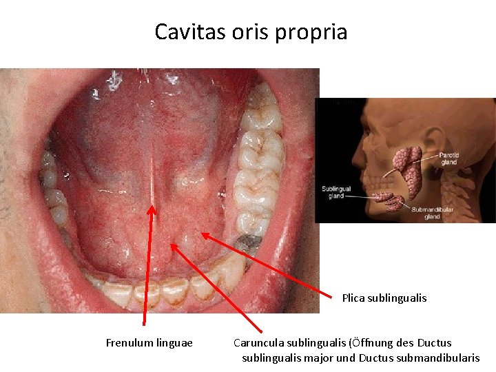 Cavitas oris propria Plica sublingualis Frenulum linguae Caruncula sublingualis (Öffnung des Ductus sublingualis major