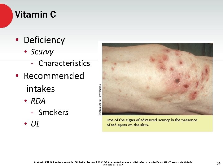 Vitamin C • Deficiency • Scurvy - Characteristics • Recommended intakes • RDA -