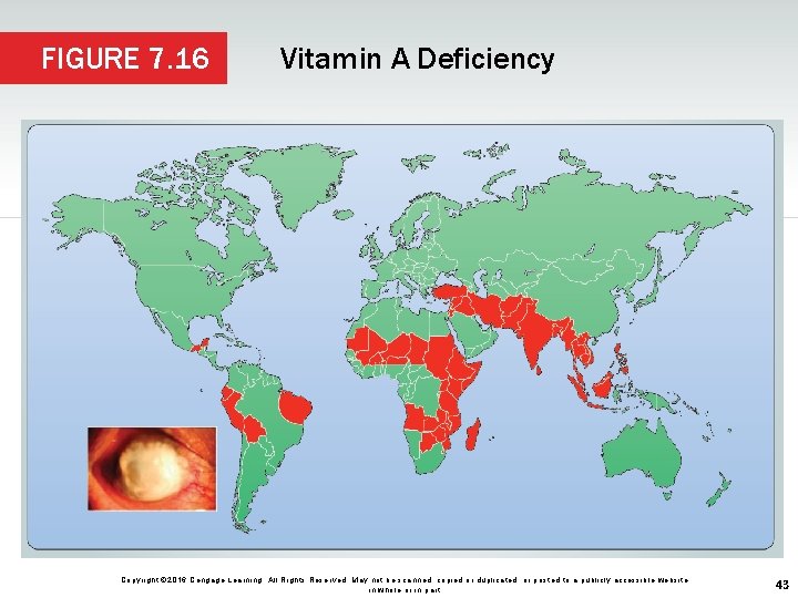 FIGURE 7. 16 Vitamin A Deficiency Copyright © 2016 Cengage Learning. All Rights Reserved.