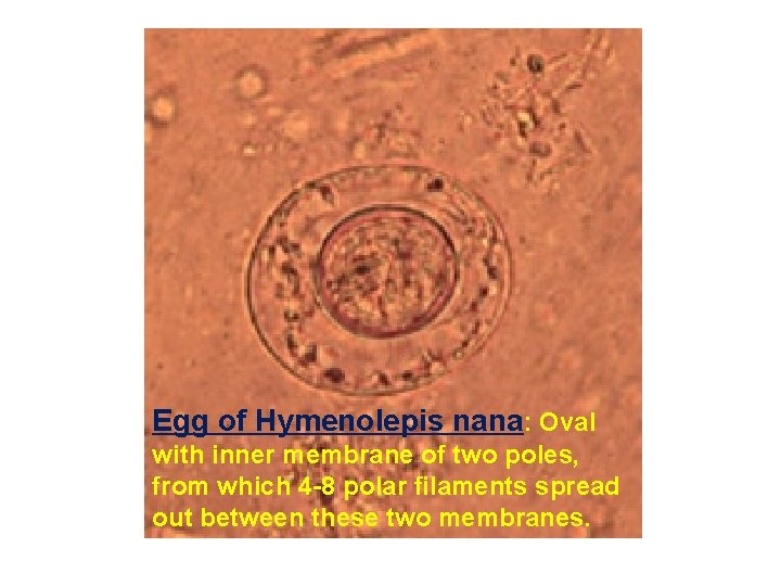 Egg of Hymenolepis nana: Oval with inner membrane of two poles, from which 4