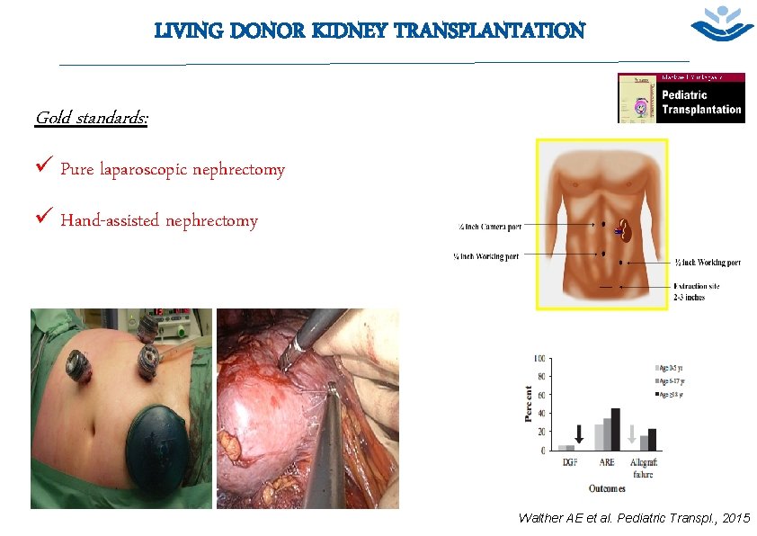 LIVING DONOR KIDNEY TRANSPLANTATION 11 Gold standards: ü Pure laparoscopic nephrectomy ü Hand-assisted nephrectomy