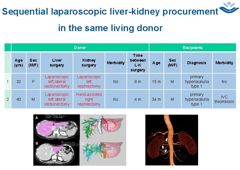 13 Sequential laparoscopic liver-kidney procurement in the same living donor Donor Age (yrs) 1