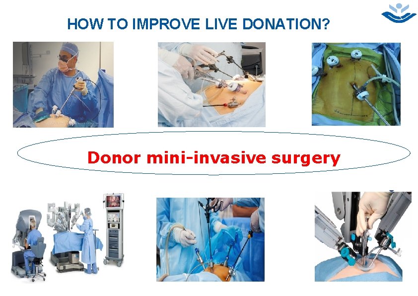 4 HOW TO IMPROVE LIVE DONATION? Donor mini-invasive surgery 