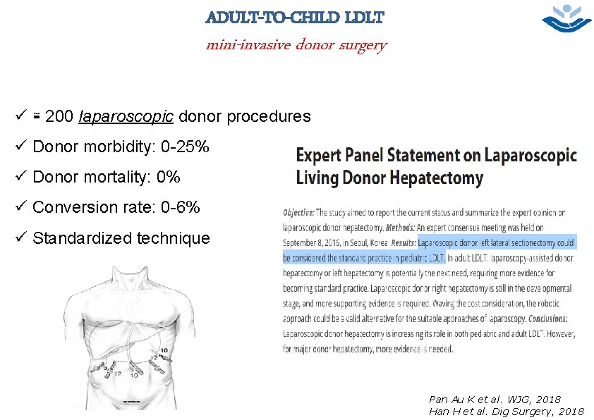 ADULT-TO-CHILD LDLT 6 mini-invasive donor surgery ü ≅ 200 laparoscopic donor procedures ü Donor