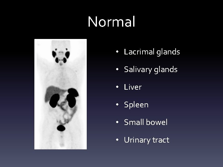 Normal • Lacrimal glands • Salivary glands • Liver • Spleen • Small bowel