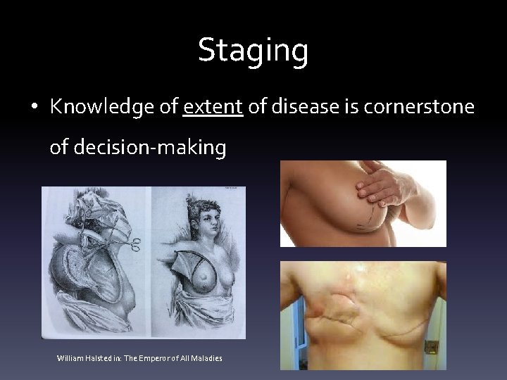 Staging • Knowledge of extent of disease is cornerstone of decision-making William Halsted in: