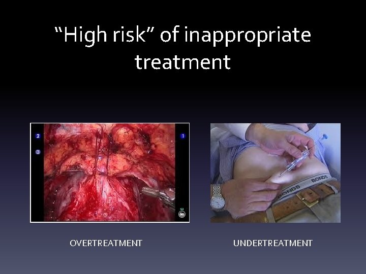 “High risk” of inappropriate treatment OVERTREATMENT UNDERTREATMENT 