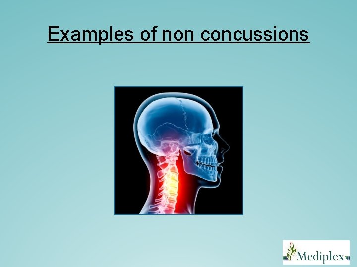 Examples of non concussions Examples of non concussions